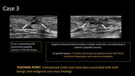 Non-Mass Findings on Breast Ultrasound