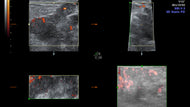 Multi-parametric Imaging of the Breast
