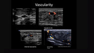 Breast Ultrasound with Dr. Harvey - Efficiency Learning Systems
