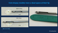 Stereotactic Biopsy Using Digital Breast Tomosynthesis