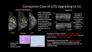 Crack the Case: Challenging Biopsy and Concordance Scenarios