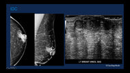 Evaluation of the Male Breast- Revisiting the 1% - Efficiency Learning Systems