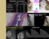 Breast Imaging CME: Hot Topics Part II - Efficiency Learning Systems