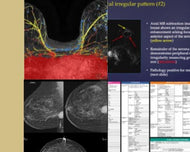 Breast Imaging CME: Hot Topics - Efficiency Learning Systems