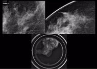 Interventional Techniques with Ultrasound, Stereotactic and MR Guidance - Efficiency Learning Systems