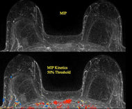 MRI Case Conference - Efficiency Learning Systems