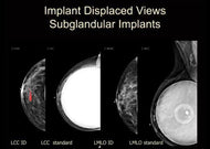 The Altered Breast - Efficiency Learning Systems